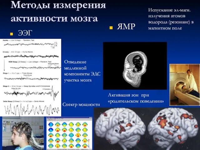 Методы измерения активности мозга ЭЭГ ЯМР Отведение медленной компоненты ЭДС участка мозга