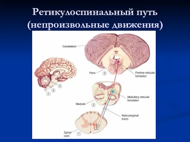 Ретикулоспинальный путь (непроизвольные движения)