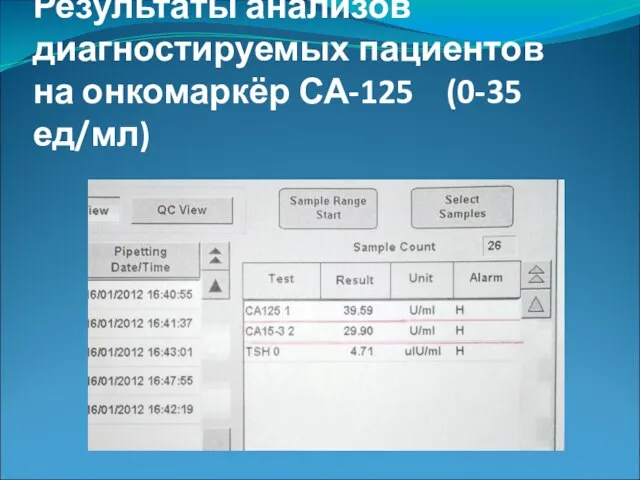 Результаты анализов диагностируемых пациентов на онкомаркёр СА-125 (0-35 ед/мл)