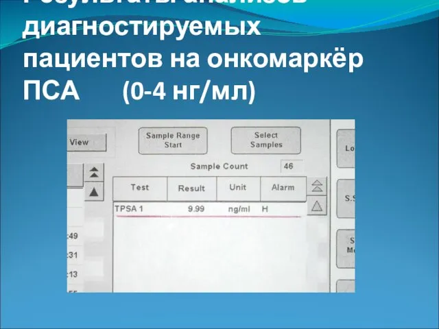 Результаты анализов диагностируемых пациентов на онкомаркёр ПСА (0-4 нг/мл)