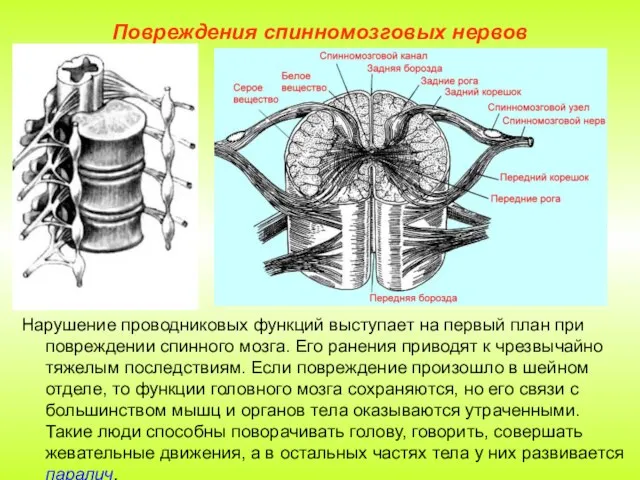 Повреждения спинномозговых нервов Нарушение проводниковых функций выступает на первый план при повреждении