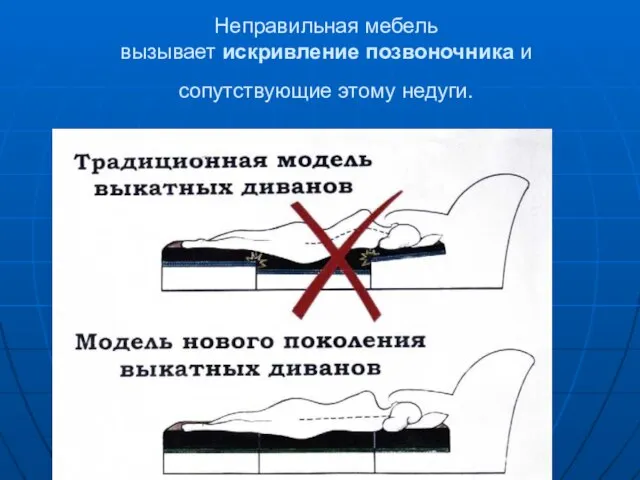 Неправильная мебель вызывает искривление позвоночника и сопутствующие этому недуги.