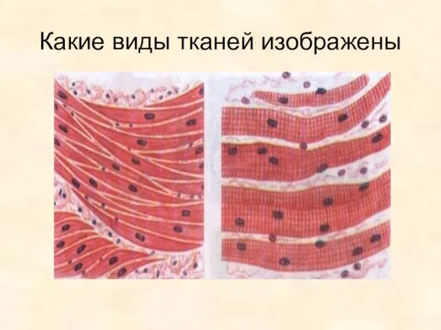 Какие виды тканей изображены