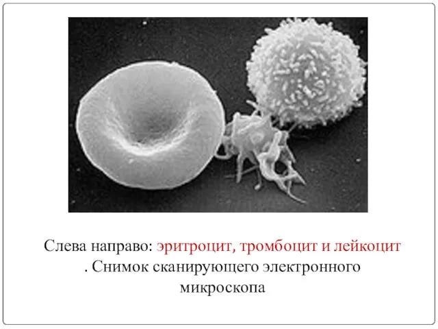 Слева направо: эритроцит, тромбоцит и лейкоцит . Снимок сканирующего электронного микроскопа