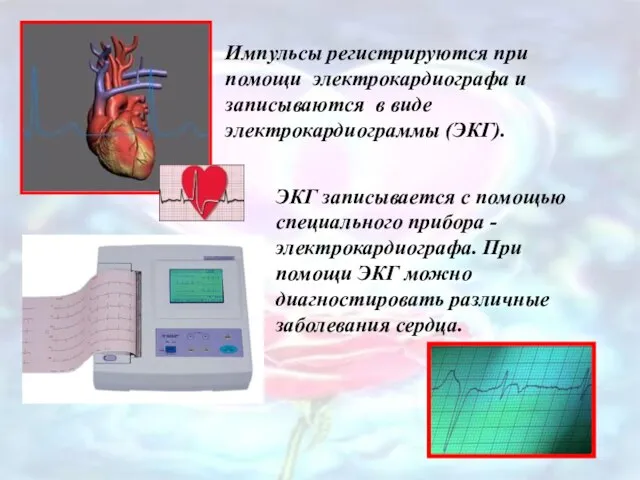 Импульсы регистрируются при помощи электрокардиографа и записываются в виде электрокардиограммы (ЭКГ). ЭКГ