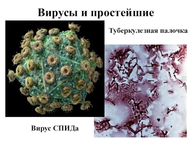 Вирусы и простейшие Вирус СПИДа Туберкулезная палочка