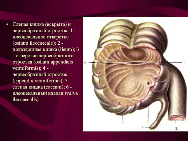 Слепая кишка (вскрыта) и червеобразный отросток. 1 - илеоцекальное отверстие (ostium ileocaecale);