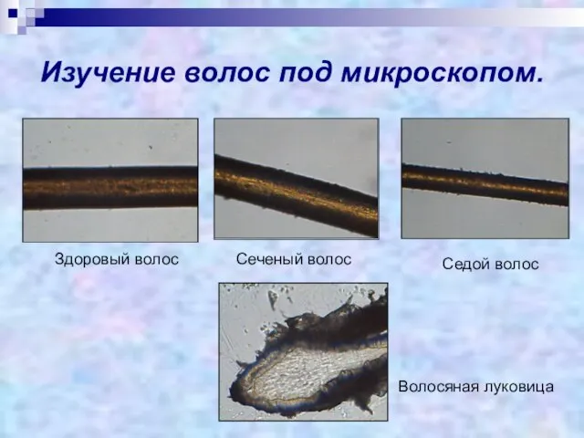 Изучение волос под микроскопом. Здоровый волос Сеченый волос Седой волос Волосяная луковица