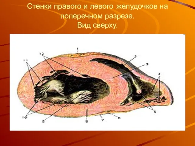 Стенки правого и левого желудочков на поперечном разрезе. Вид сверху.