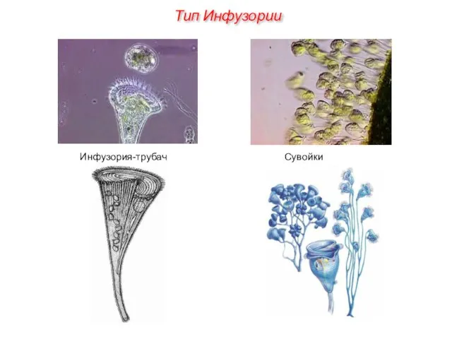 Инфузория-трубач Сувойки Тип Инфузории