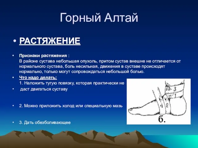 Горный Алтай РАСТЯЖЕНИЕ Признаки растяжения : В районе сустава небольшая опухоль, притом