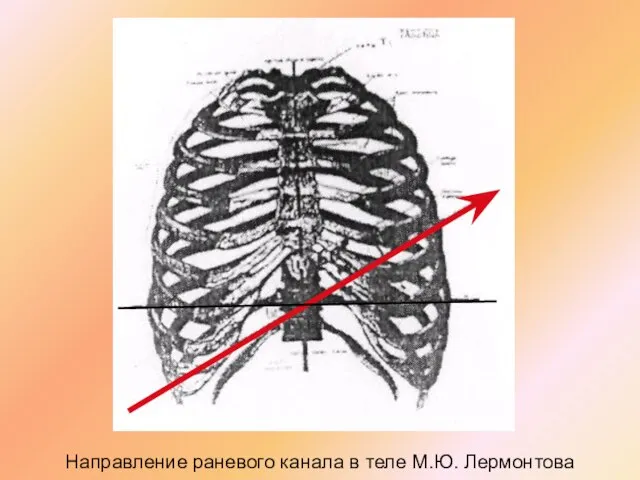 Направление раневого канала в теле М.Ю. Лермонтова