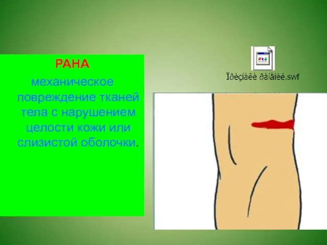 РАНА механическое повреждение тканей тела с нарушением целости кожи или слизистой оболочки.