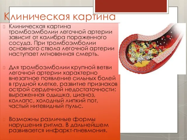 Клиническая картина Клиническая картина тромбоэмболии легочной артерии зависит от калибра пораженного сосуда.