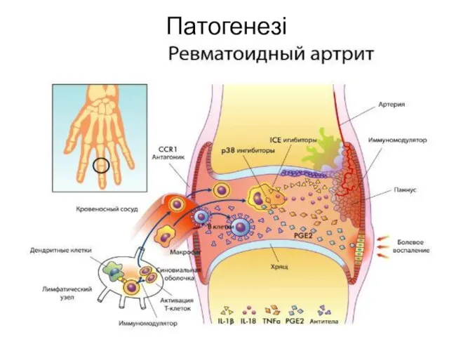 Патогенезі