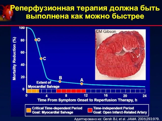 Реперфузионная терапия должна быть выполнена как можно быстрее Адаптировано из: Gersh BJ, et al. JAMA. 2005;293:979.