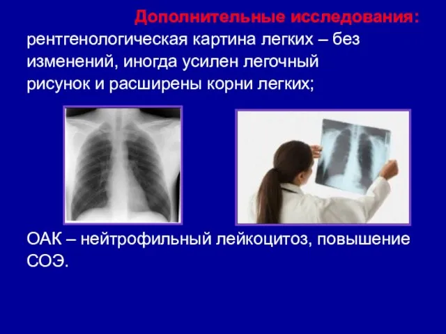 Дополнительные исследования: рентгенологическая картина легких – без изменений, иногда усилен легочный рисунок