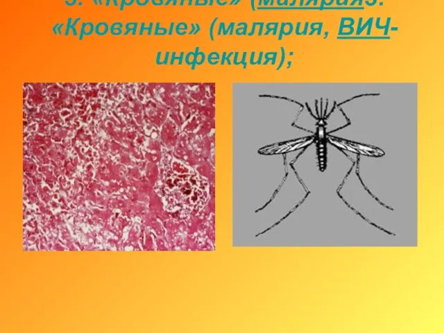 3. «Кровяные» (малярия3. «Кровяные» (малярия, ВИЧ-инфекция);