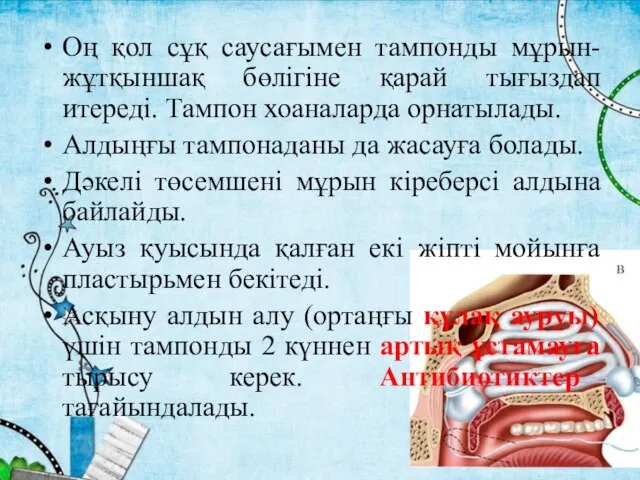 Оң қол сұқ саусағымен тампонды мұрын-жұтқыншақ бөлігіне қарай тығыздап итереді. Тампон хоаналарда