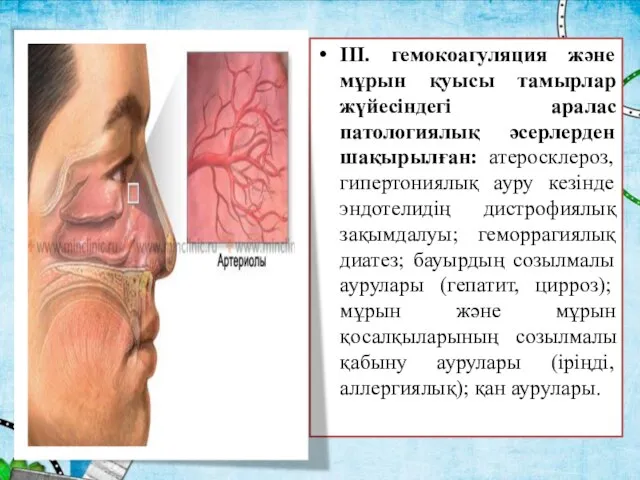 III. гемокоагуляция және мұрын қуысы тамырлар жүйесіндегі аралас патологиялық әсерлерден шақырылған: атеросклероз,