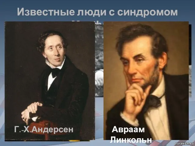 Известные люди с синдромом Марфана: Н. Паганини К.И. Чуковский Г.-Х.Андерсен Авраам Линкольн