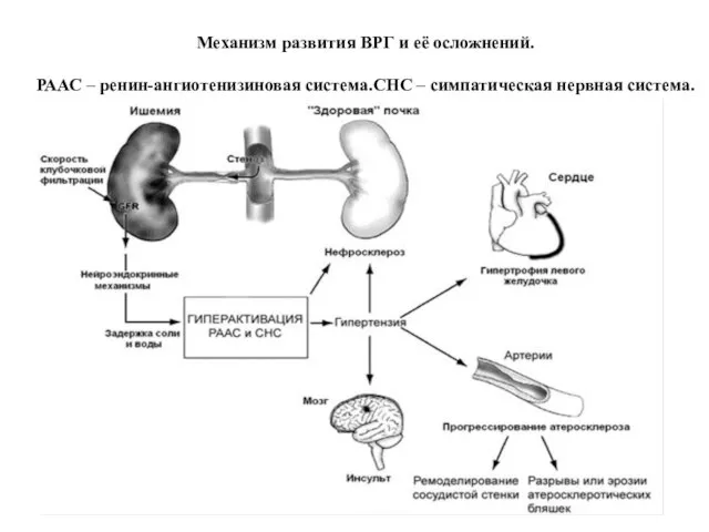 Механизм развития ВРГ и её осложнений. РААС – ренин-ангиотенизиновая система.СНС – симпатическая нервная система.