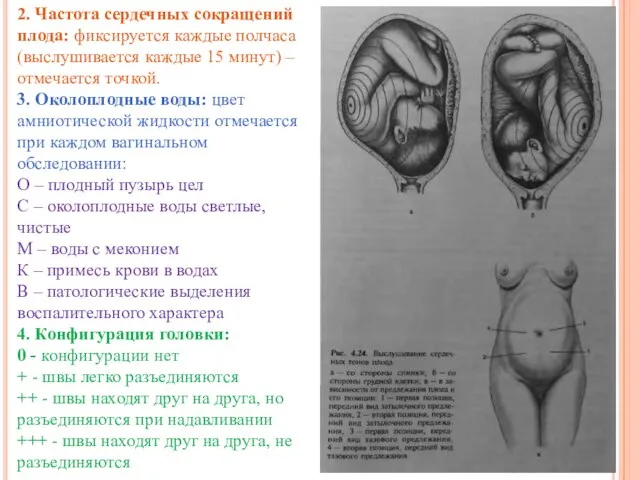 2. Частота сердечных сокращений плода: фиксируется каждые полчаса (выслушивается каждые 15 минут)