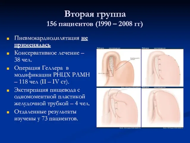 Вторая группа 156 пациентов (1990 – 2008 гг) Пневмокардиодилятация не применялась Консервативное