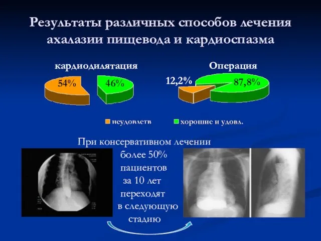 Результаты различных способов лечения ахалазии пищевода и кардиоспазма 46% 54% 87,8% 12,2%