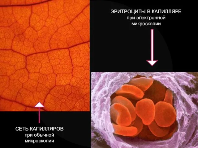 СЕТЬ КАПИЛЛЯРОВ при обычной микроскопии ЭРИТРОЦИТЫ В КАПИЛЛЯРЕ при электронной микроскопии