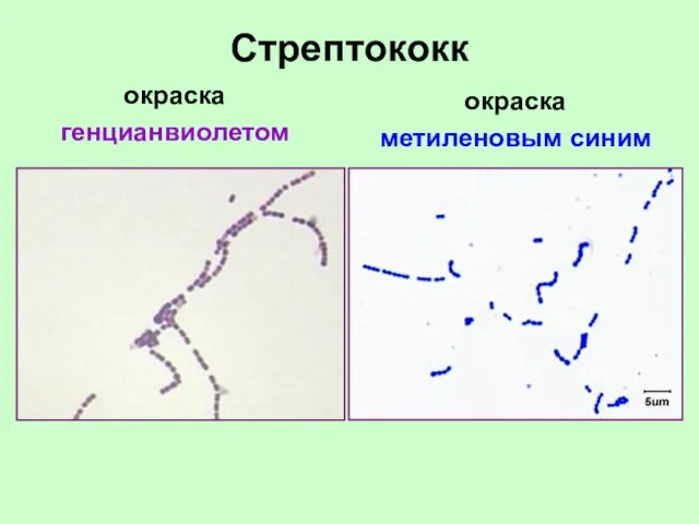 Стрептококк окраска генцианвиолетом окраска метиленовым синим