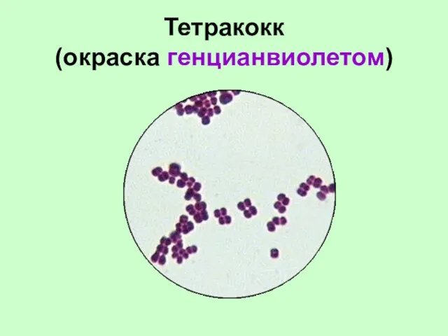 Тетракокк (окраска генцианвиолетом)