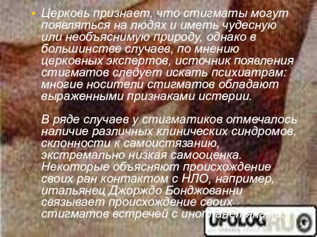 Церковь признает, что стигматы могут появляться на людях и иметь чудесную или