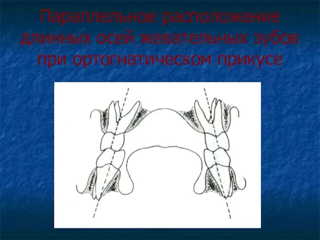 Параллельное расположение длинных осей жевательных зубов при ортогнатическом прикусе