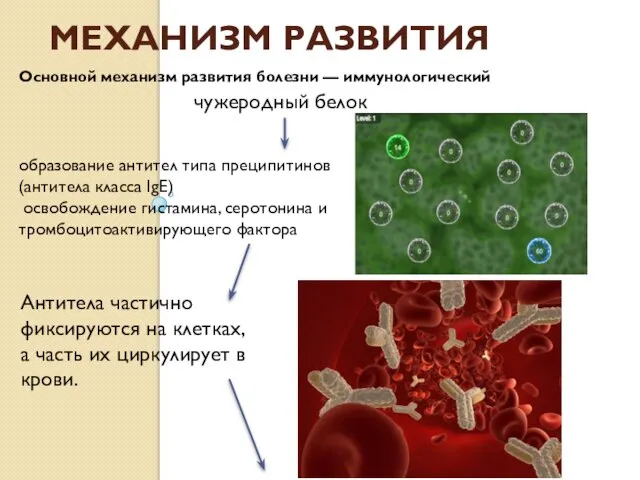 Механизм развития Основной механизм развития болезни — иммунологический чужеродный белок образование антител