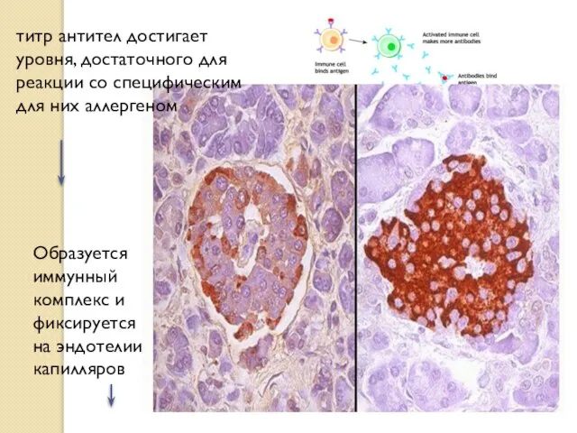 титр антител достигает уровня, достаточного для реакции со специфическим для них аллергеном