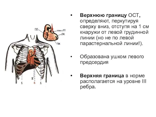 Верхнюю границу ОСТ, определяют, перкутируя сверху вниз, отступя на 1 см кнаружи