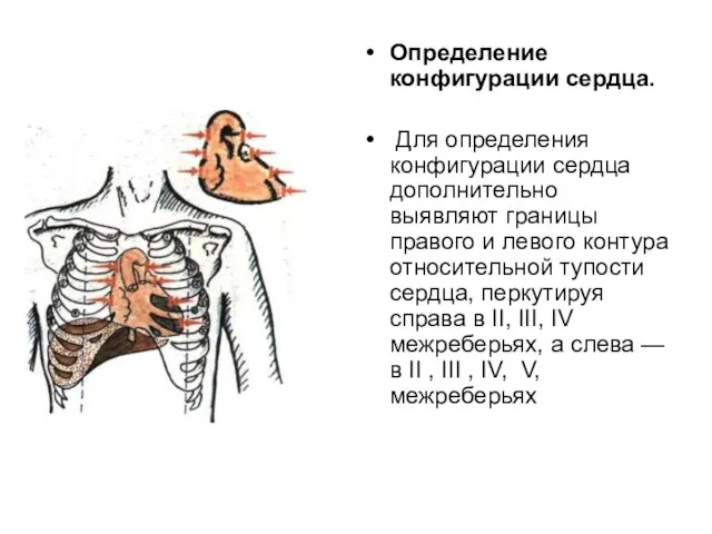 Определение конфигурации сердца. Для определения конфигурации сердца дополнительно выявляют границы правого и