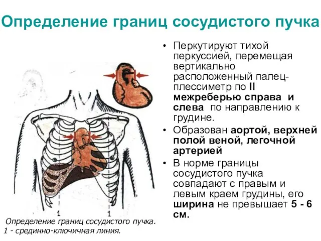 Определение границ сосудистого пучка Перкутируют тихой перкуссией, перемещая вертикально расположенный палец-плессиметр по