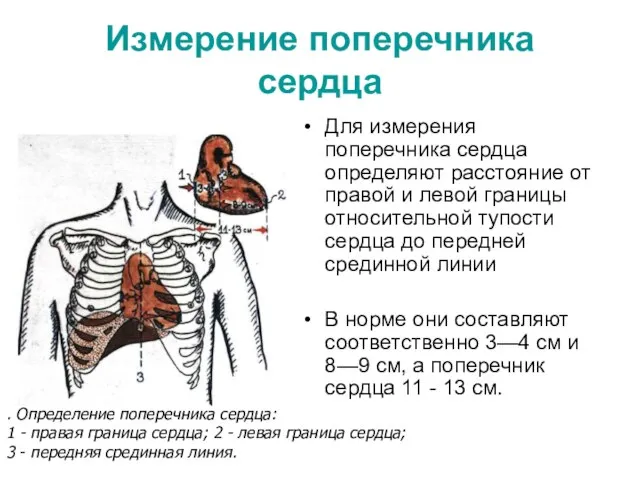 Измерение поперечника сердца Для измерения поперечника сердца определяют расстояние от правой и