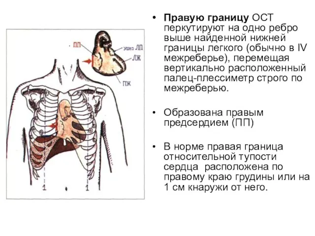 Правую границу ОСТ перкутируют на одно ребро выше найденной нижней границы легкого