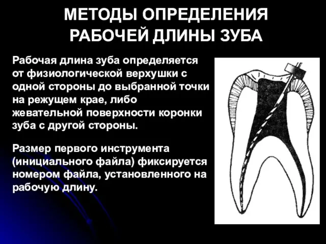 МЕТОДЫ ОПРЕДЕЛЕНИЯ РАБОЧЕЙ ДЛИНЫ ЗУБА Рабочая длина зуба определяется от физиологической верхушки