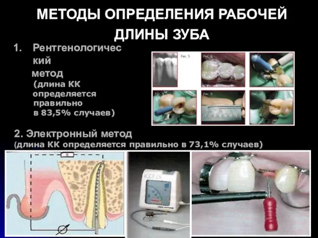 МЕТОДЫ ОПРЕДЕЛЕНИЯ РАБОЧЕЙ ДЛИНЫ ЗУБА 2. Электронный метод (длина КК определяется правильно