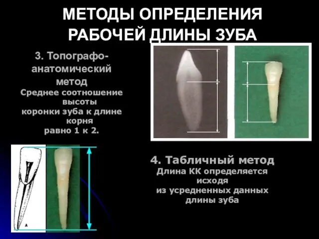 МЕТОДЫ ОПРЕДЕЛЕНИЯ РАБОЧЕЙ ДЛИНЫ ЗУБА 3. Топографо- анатомический метод Среднее соотношение высоты