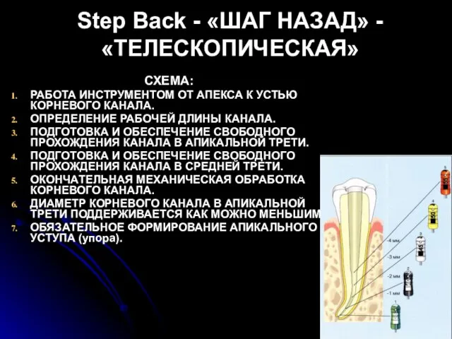 Step Back - «ШАГ НАЗАД» - «ТЕЛЕСКОПИЧЕСКАЯ» СХЕМА: РАБОТА ИНСТРУМЕНТОМ ОТ АПЕКСА