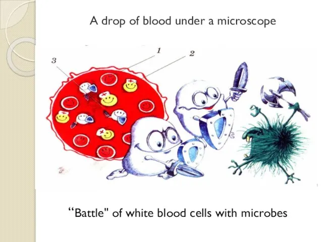 A drop of blood under a microscope “Battle" of white blood cells with microbes