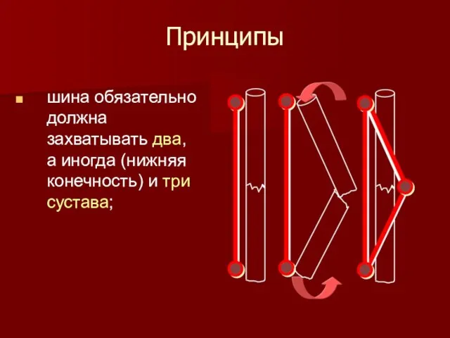 Принципы шина обязательно должна захватывать два, а иногда (нижняя конечность) и три сустава;