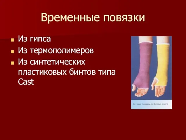 Временные повязки Из гипса Из термополимеров Из синтетических пластиковых бинтов типа Сast