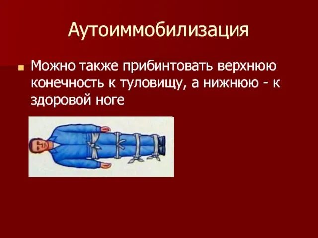 Аутоиммобилизация Можно также прибинтовать верхнюю конечность к туловищу, а нижнюю - к здоровой ноге