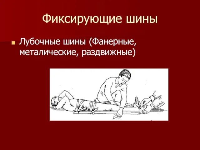 Фиксирующие шины Лубочные шины (Фанерные, металические, раздвижные)